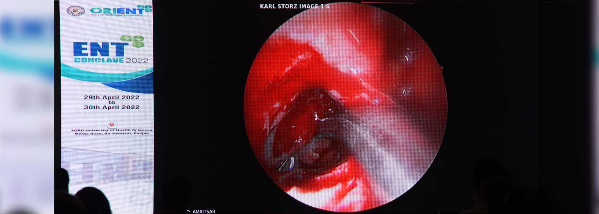 galimgs/ENT CONCLAVE 2022 - International Live Surgical Conference/P - 7.jpg